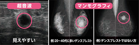 ultrasound2005.jpg