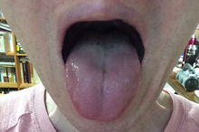 舌－２