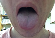 舌－１